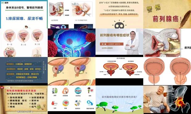 汕头前列腺癌的医院排名 - 汕头前列腺癌的症状