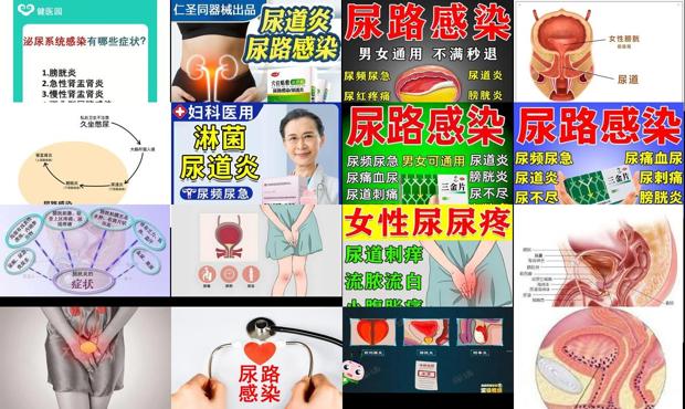 急性膀胱尿道炎 - 汕头尿道炎膀胱炎症状图片