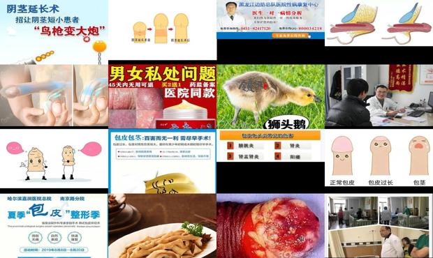 汕头男科医院哪里好 - 汕头阴茎炎症哪个医院好