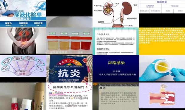 尿到炎能治好吗 - 汕头尿炎症是怎么引起的吗