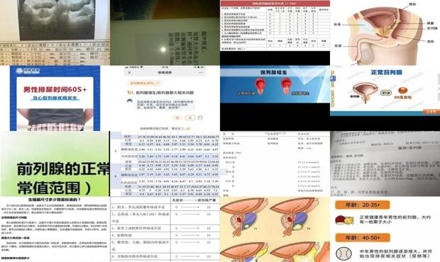 前列腺大小65&times;50 - 汕头前列腺大小的正常标准是多少