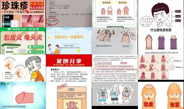 揭阳包皮有炎症 - 汕头包皮有炎症怎么办