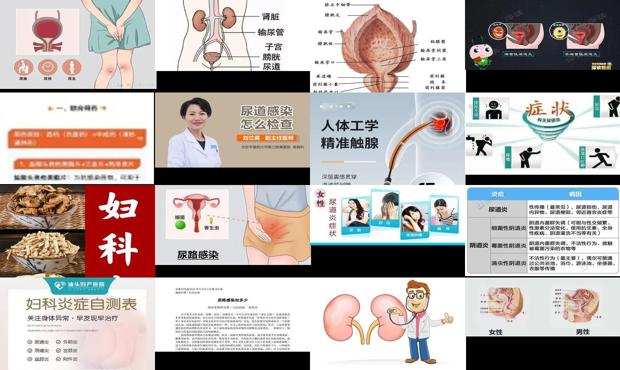 你尿道炎 - 汕头尿道炎症怎么办