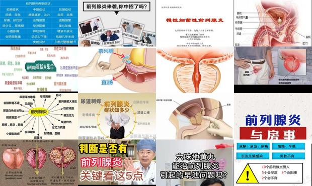 我说的是前列腺炎 - 汕头前列腺炎是什么引起的