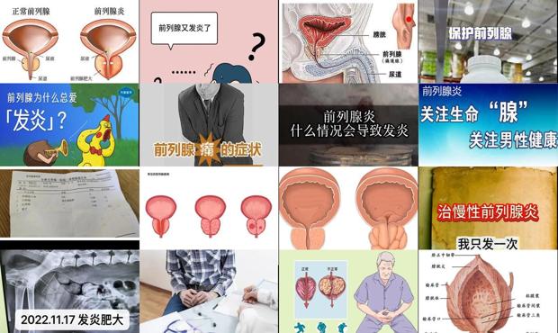 前列腺发炎是什么病 - 汕头前列腺发炎
