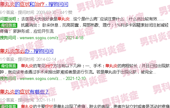 汕头睾丸炎症状怎么治疗