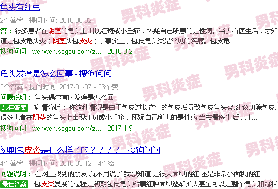 汕头阴茎皮炎症状和图片