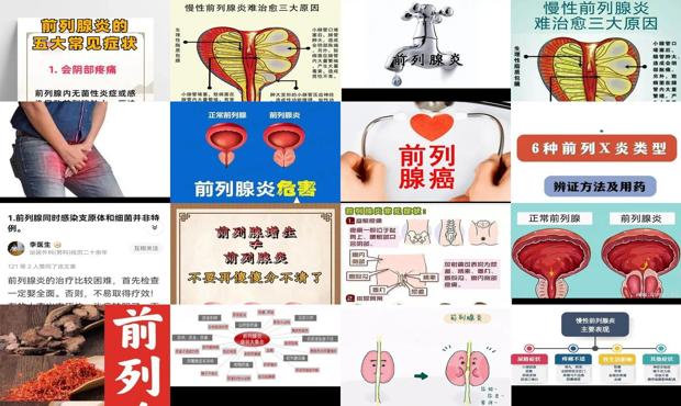 汕头治疗前列腺炎中医专家 - 汕头前列腺炎 症状