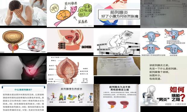 汕头哪里看前列腺炎好 - 汕头什么前列腺炎症