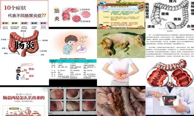 肠炎症是什么症状 - 汕头肠炎症状