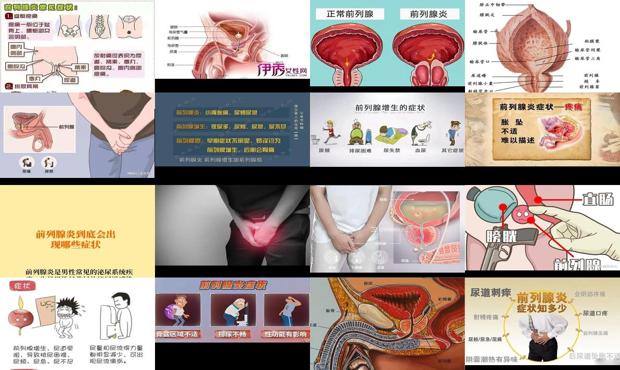 汕头前列腺哪个医院好 - 汕头得了前列腺是什么症状