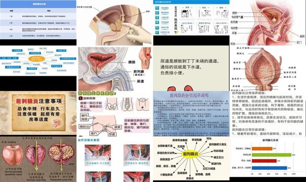 前列腺炎医治方法 - 汕头前列腺炎的由来