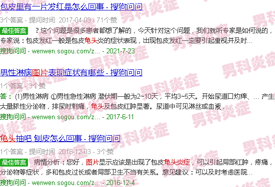 汕头龟头炎症图片大*