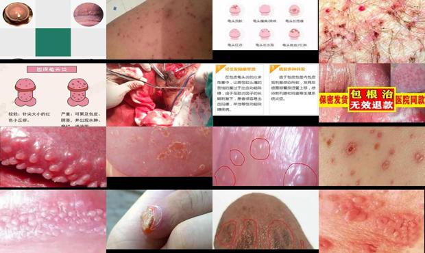 汕头龟的图片 - 汕头龟头炎症图片大全