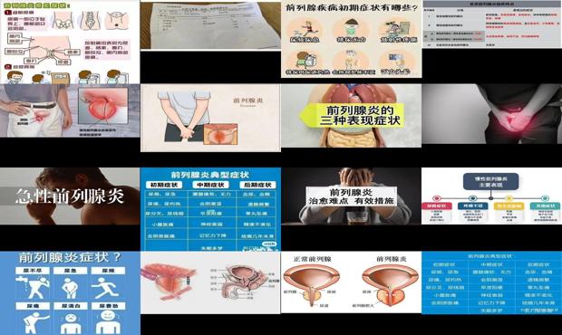 前列腺炎最新动态 - 汕头前列腺炎表现