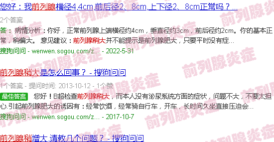 汕头前列腺稍大