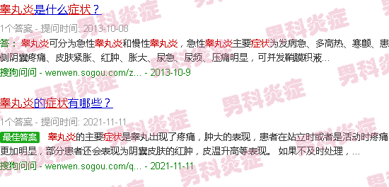汕头睾丸炎症状图片