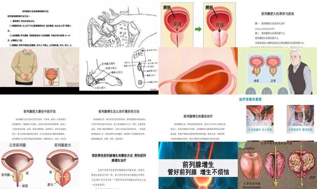 前列腺肥大根治方法 - 汕头前列腺肥大怎么治疗最好的方法
