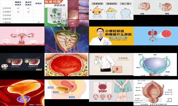 汕头什么最出名 - 汕头什么是尿道炎症