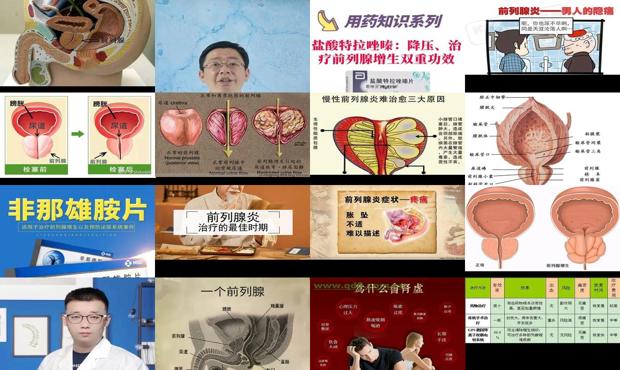 汕头前列腺该怎么治