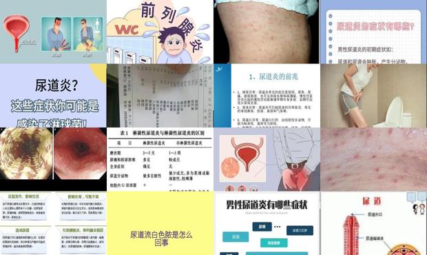 汕头男性慢性疾病医院 - 汕头男性慢性尿道炎症状表现