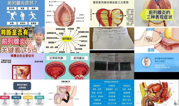 前泪腺有炎症怎么办 - 汕头前泪腺炎症状
