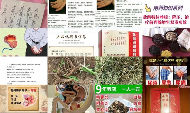 中医治头痛 - 汕头土方治前列腺