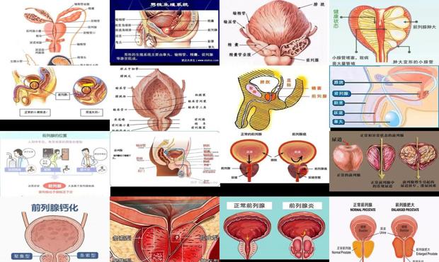 汕头前列腺手术 - 汕头前列腺是什么意思