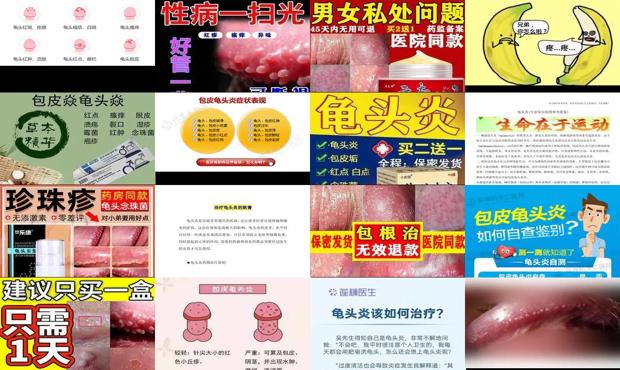 汕头男科性疾病 - 汕头龟头炎症怎么治