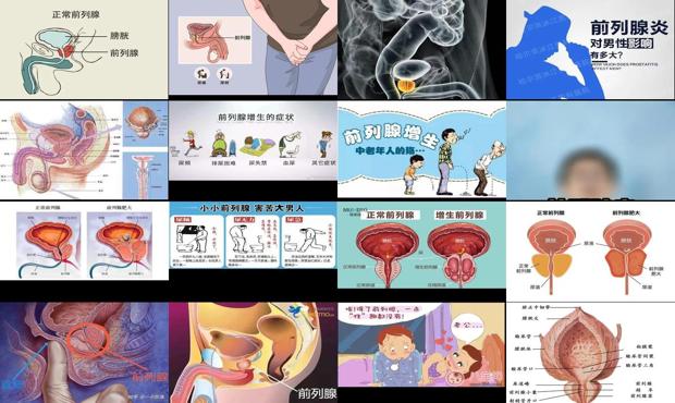 汕头哪里看前列腺炎好 - 汕头前列腺怎样生活