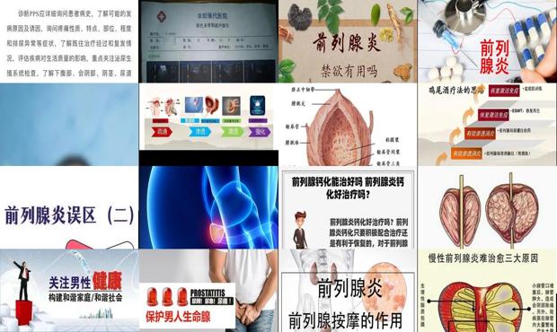 前列腺炎可以吃药吗 - 汕头前列腺炎可以治疗吗