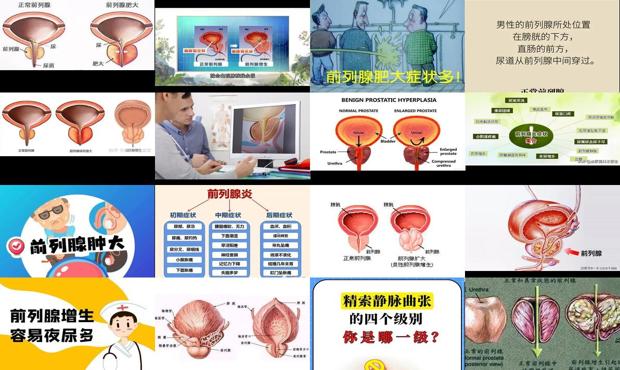 汕头前列腺肥大医院排名 - 汕头前列腺肥大的症状有哪些