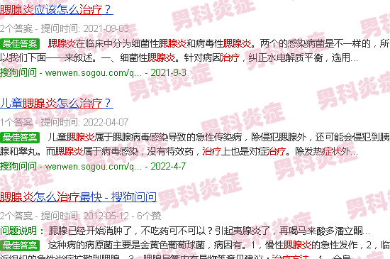 汕头腮腺炎症状治疗方法