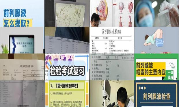 前列腺液是做什么用的 - 汕头前列腺液怎么检查的