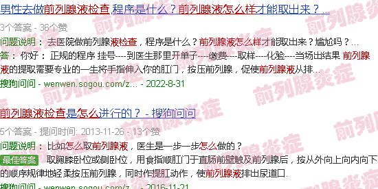 汕头前列腺液怎么检查的