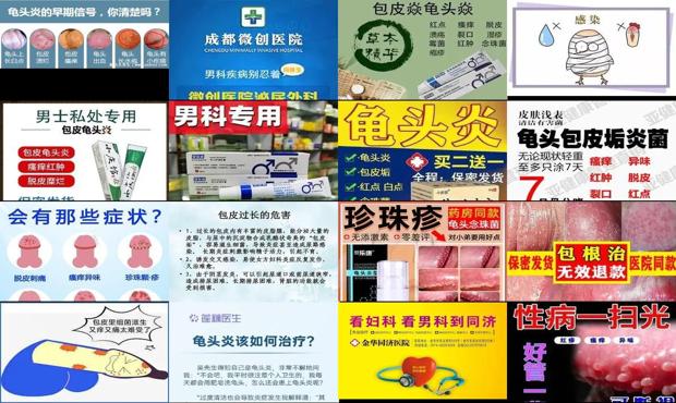 揭阳包皮有炎症 - 汕头包皮炎症怎么治疗
