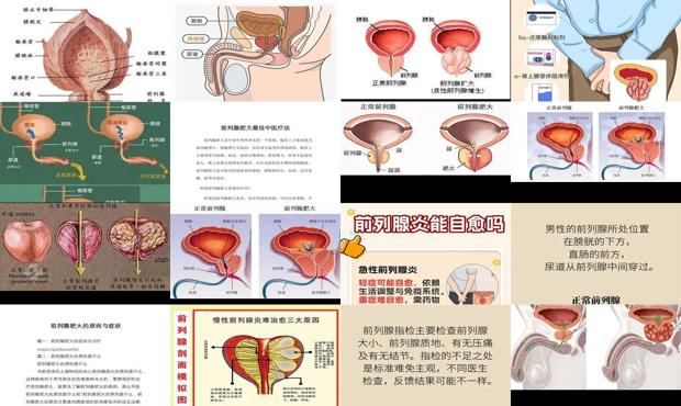 前列腺肥大与性生活有关系吗 - 汕头前列腺肥大能自愈吗