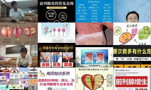 前列腺肥大怎么手术治疗 - 汕头前列腺大怎么治