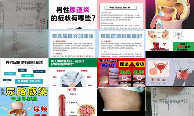 这个尿道炎怎么治 - 汕头尿道炎症状男