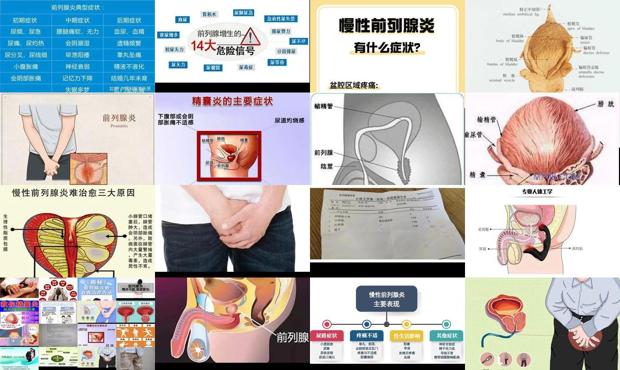 前列腺炎一般怎么治疗的?多少钱? - 汕头前列腺炎症状