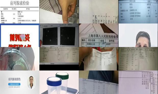 汕头前列腺液是什么
