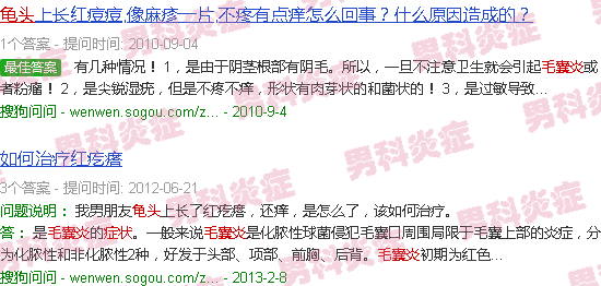 汕头龟头毛囊炎症状图片