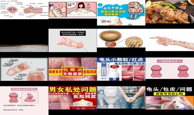 汕头有男性男科医院吗 - 汕头阴茎有炎症