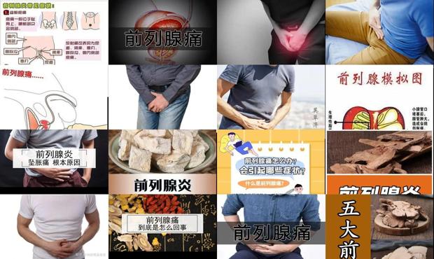 前列腺痛表现症状有哪些 - 汕头前列腺痛