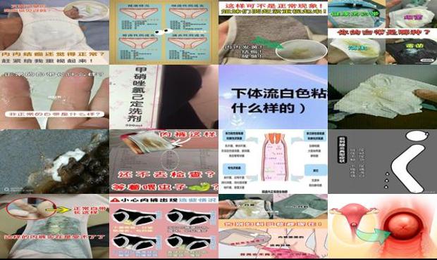 一直流白色液体不来月经 - 汕头白色液体流出是不是炎症