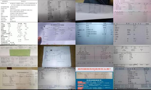 前列腺液常规检查能查出什么病 - 汕头前列腺液常规