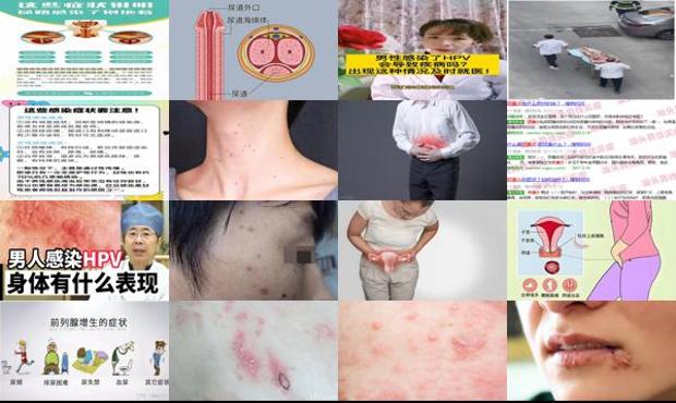 汕头确诊 - 汕头男性被感染了炎症有什么症状