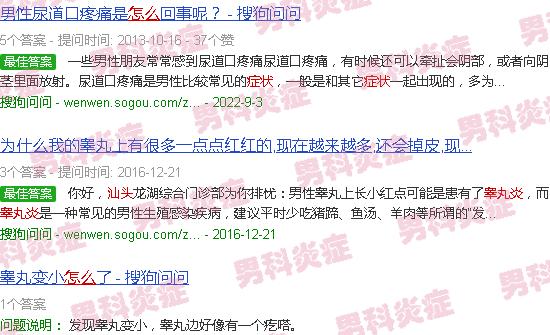 汕头睾丸炎症状怎样的
