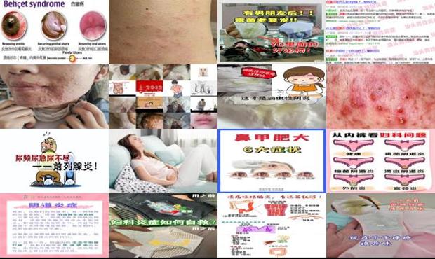 男人下面有阴虱什么原因 - 汕头男的下面有炎症的症状怎么办