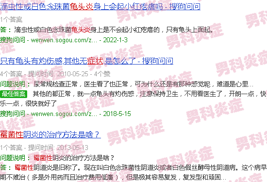 汕头梅菌性龟头炎症状